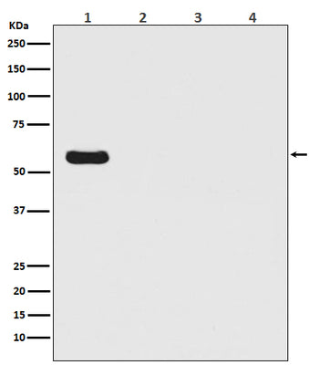 Anti-Firefly Luciferase Rabbit Monoclonal Antibody Boster Bio