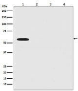 Anti-Firefly Luciferase Rabbit Monoclonal Antibody Boster Bio
