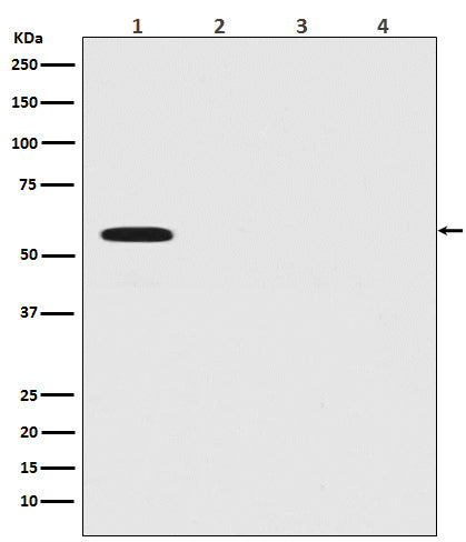 Anti-Firefly Luciferase Rabbit Monoclonal Antibody Boster Bio