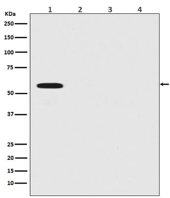 Anti-Firefly Luciferase Rabbit Monoclonal Antibody Boster Bio