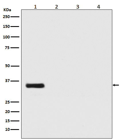 Anti-Renilla Luciferase Rabbit Monoclonal Antibody Boster Bio