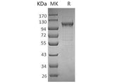 Recombinant Human MANSC1 Protein (His Tag) - ABMIUM