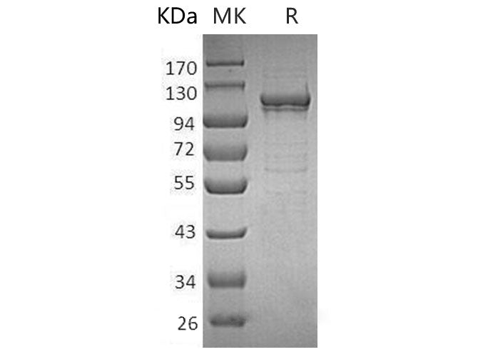 Recombinant Human MANSC1 Protein (His Tag) - ABMIUM