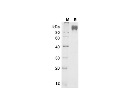 SDS-PAGE analysis of Mouse M-CSF R/CD115 proteins , 2 μg/lane of Recombinant Mouse M-CSF R/CD115 proteins was resolved with SDS-PAGE under reducing conditions , showing bands at 90-100 kDa.
