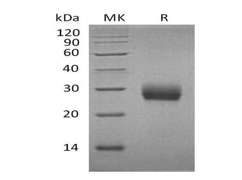 Recombinant Mouse RANK/TNFRSF11A Protein (His Tag) - ABMIUM