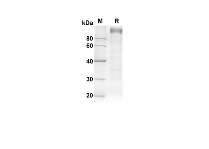 SDS-PAGE analysis of Rat TLR4 proteins, 2 μg/lane of Recombinant Rat TLR4 proteins was resolved with an SDS-PAGE under reducing conditions, showing bands at 91.3 kDa.