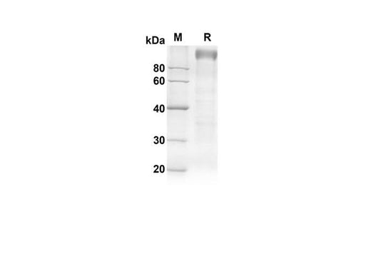 SDS-PAGE analysis of Rat TLR4 proteins, 2 μg/lane of Recombinant Rat TLR4 proteins was resolved with an SDS-PAGE under reducing conditions, showing bands at 91.3 kDa.