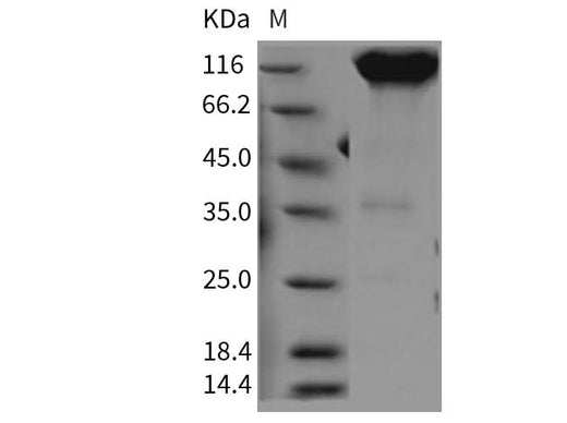 Recombinant Rat PDGFRa/CD140a Protein (Fc Tag) - ABMIUM