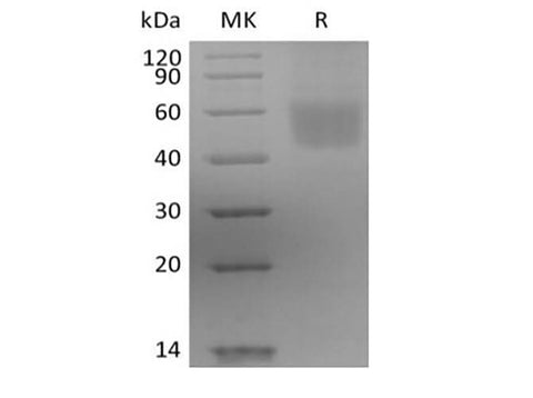 Recombinant Human IL-3 Receptor Subunit Alpha/IL-3RA/CD123 (C-6His) - ABMIUM