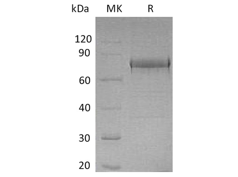 Recombinant Human EphA1 Protein (His Tag) - ABMIUM