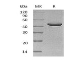 Recombinant Human SerpinB3/SCCA1 Protein (Human Cells, His Tag) - ABMIUM