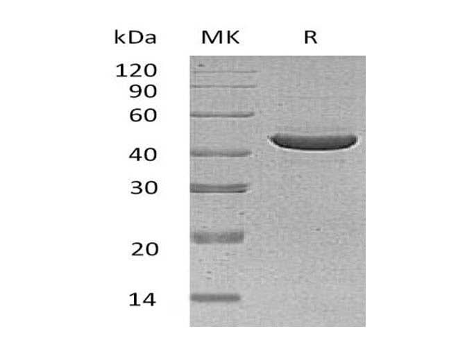 Recombinant Human SerpinB3/SCCA1 Protein (Human Cells, His Tag) - ABMIUM
