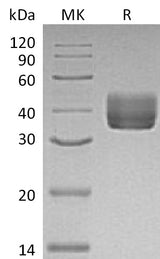 Recombinant Mouse CD157/BST1 Protein (His Tag) - ABMIUM