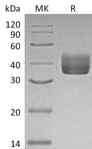 Recombinant Mouse CD157/BST1 Protein (His Tag) - ABMIUM