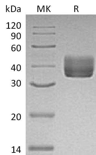 Recombinant Mouse CD157/BST1 Protein (His Tag) - ABMIUM