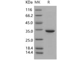 Recombinant Human Carbonic Anhydrase 5B/CA5B Protein (His Tag) - ABMIUM