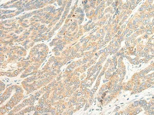Anti-Human/Mouse TTC4 Antibody