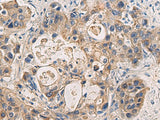 Anti-Human/Mouse DMRTA2 Antibody - ABMIUM
