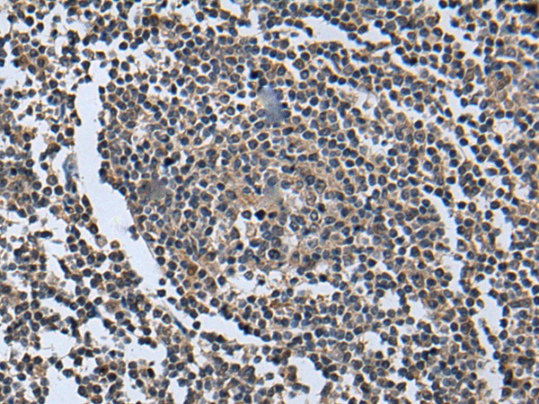 Immunohistochemistry of paraffin-embedded Human tonsil tissue using WNT9B Polyclonal Antibody at dilution of 1:85(×200)