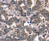 Anti-Human/Mouse/Rat FGFR1OP2 Antibody - ABMIUM