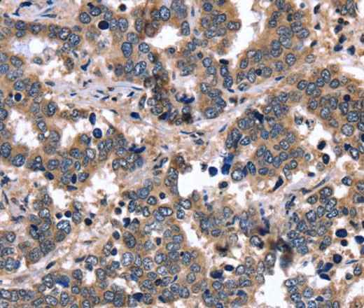 Anti-Human/Mouse/Rat FGFR1OP2 Antibody