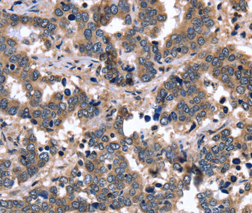 Anti-Human/Mouse/Rat FGFR1OP2 Antibody - ABMIUM