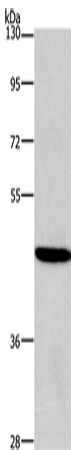 Anti-Human/Mouse/Rat HDAC8 Antibody - ABMIUM