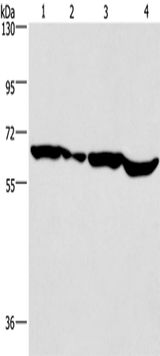 Anti-Human/Mouse SOX18 Antibody - ABMIUM