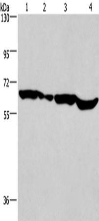 Anti-Human/Mouse SOX18 Antibody - ABMIUM