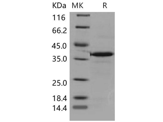 > 88 % as determined by reducing SDS-PAGE.