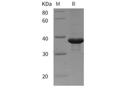 SDS-PAGE analysis of mouse TGF-beta 2/TGFB2 proteins, 2 μg/lane of Recombinant mouse TGF-beta 2/TGFB2 proteins was resolved with SDS-PAGE under reducing conditions, showing bands at 38 kDa.