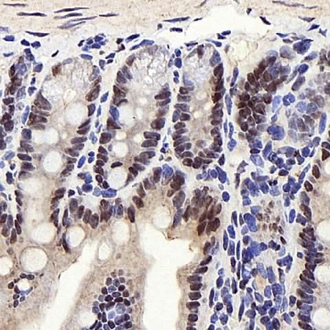 Immunohistochemistry analysis of paraffin-embedded mouse colon using PPARA Polyclonal Antibody at dilution of 1:300.
