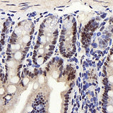 Immunohistochemistry analysis of paraffin-embedded mouse colon using PPARA Polyclonal Antibody at dilution of 1:300.