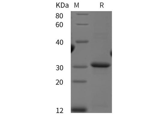 SDS-PAGE analysis of Human PD-L1/B7-H1/CD274 proteins, 2 μg/lane of Recombinant Human PD-L1/B7-H1/CD274 proteins was resolved with SDS-PAGE under reducing conditions, showing bands at 31 kDa.