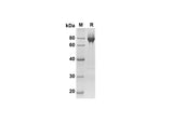 SDS-PAGE analysis of Mouse CA9 proteins, 2 μg/lane of Recombinant Mouse CA9 proteins was resolved with SDS-PAGE under reducing conditions, showing bands at 64.3 kDa.