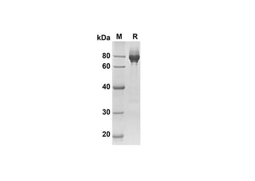 SDS-PAGE analysis of Mouse CA9 proteins, 2 μg/lane of Recombinant Mouse CA9 proteins was resolved with SDS-PAGE under reducing conditions, showing bands at 64.3 kDa.