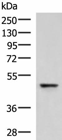 Western blot analysis of Human fetal liver tissue lysate using RMDN2 Polyclonal Antibody at dilution of 1:750