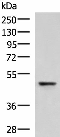Western blot analysis of Human fetal liver tissue lysate using RMDN2 Polyclonal Antibody at dilution of 1:750