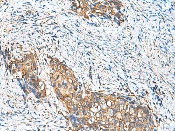 Anti-Human/Mouse CAMSAP3 Antibody
