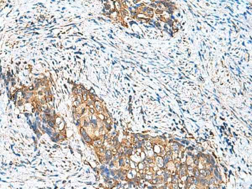 Anti-Human/Mouse CAMSAP3 Antibody