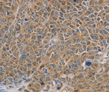 Anti-Human/Mouse NDUFS7 Antibody - ABMIUM