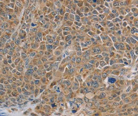 Anti-Human/Mouse NDUFS7 Antibody