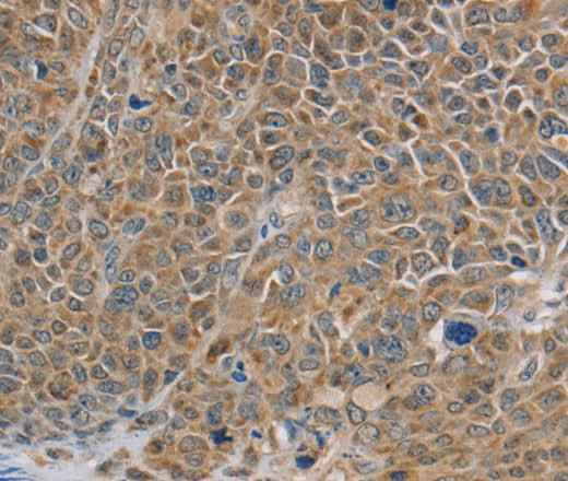 Anti-Human/Mouse NDUFS7 Antibody