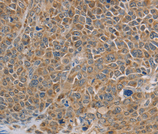 Anti-Human/Mouse NDUFS7 Antibody - ABMIUM