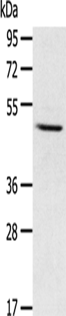 Anti-Human/Mouse/Rat CYP1A1 Antibody - ABMIUM