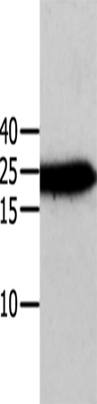 Anti-Human/Mouse/Rat ANXA5 Antibody - ABMIUM