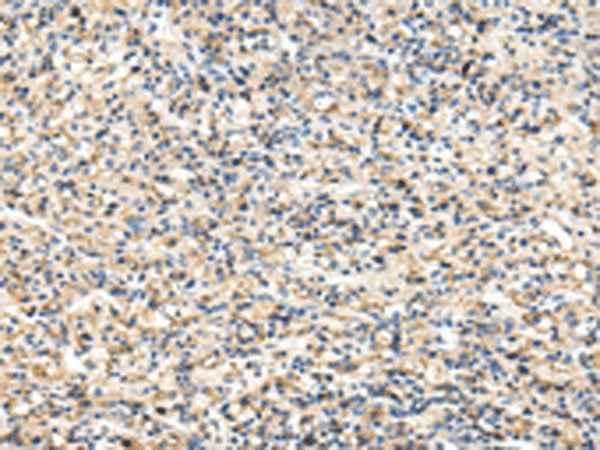 Anti-Human/Mouse/Rat VCAM1 Antibody