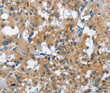 Anti-Human/Mouse/Rat CREB2 Antibody - ABMIUM