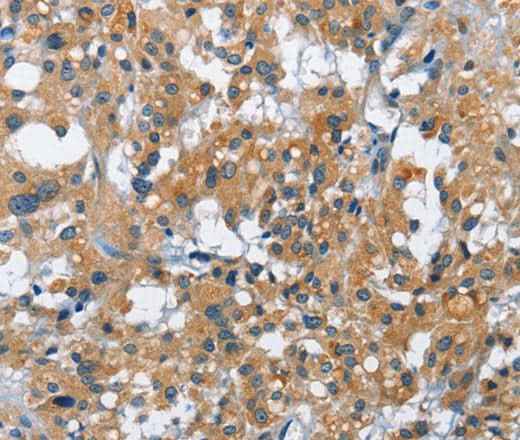 Anti-Human/Mouse/Rat CREB2 Antibody