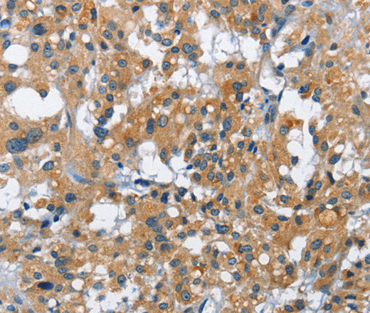 Anti-Human/Mouse/Rat CREB2 Antibody - ABMIUM